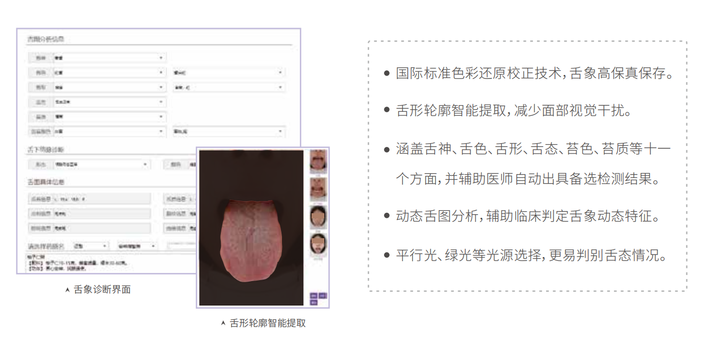 中醫(yī)舌診儀（舌象信息采集管理系統(tǒng)）MT-SX-02舌象分析特點(diǎn).png